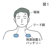 図1