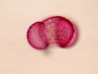 マツ花粉の顕微鏡写真2